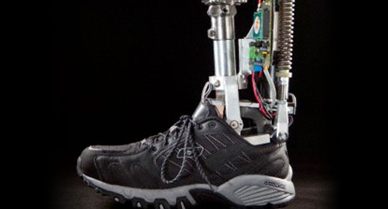 Why Do Biomedical Engineering myUCD Blog