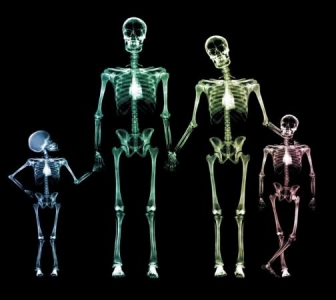 Why choose radiography in UCD?